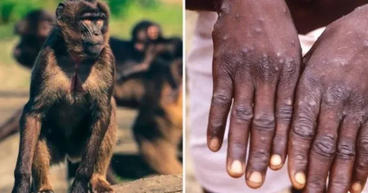 Mutasiyaya uğramış meymun çiçəyi yayılır: ÜST dən həyəcan təbili