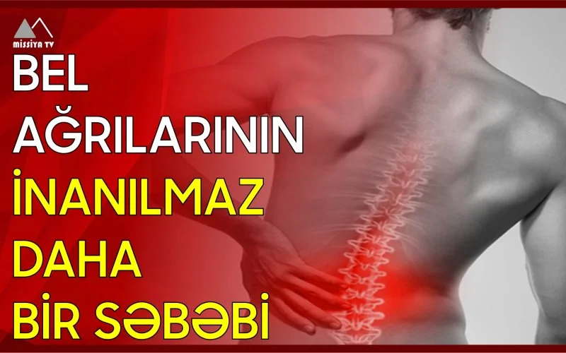 Bel ağrılarının inanılmaz daha bir səbəbi