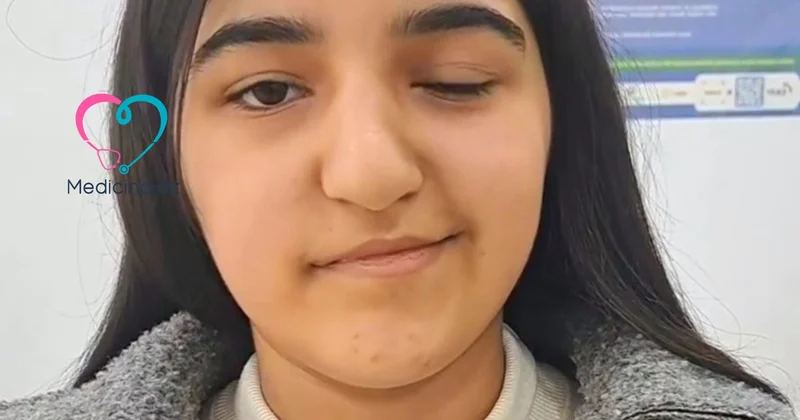 İnfluenza virusu yeniyetmənin üzünü iflic etdi VİDEO