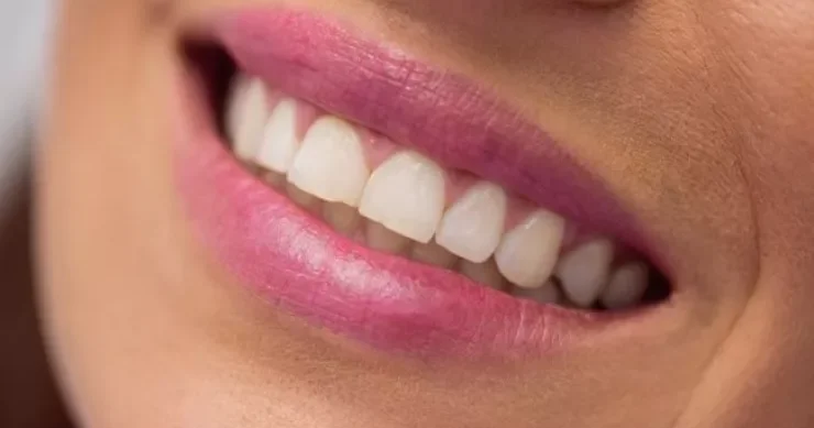 Dişlərinizin sağlam qalması üçün hər yeməkdən sonra bunları edin