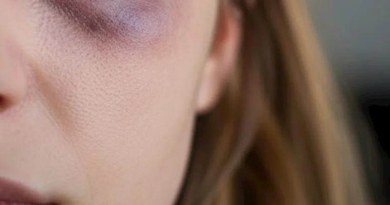 150 manata görə qadını döydü Əfsanə arvadımın saçını yoldu