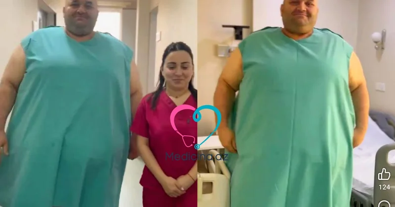 Azərbaycanda 330 kq çəkili kişi əməliyyat olundu Video