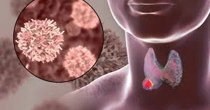 Xərçəngə səbəb ola bilən vitaminlər: ARAŞDIRMA