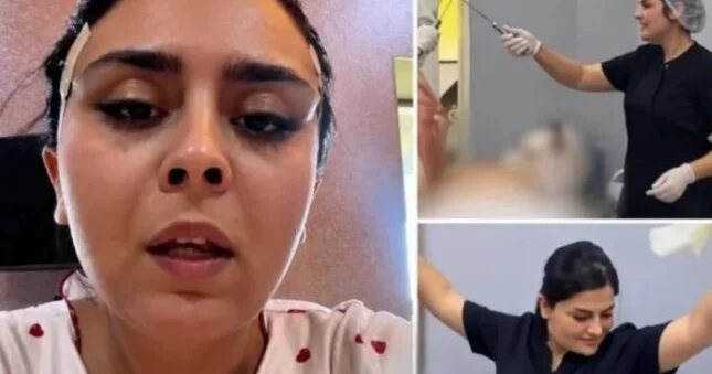 Sinirlərimi kəsib əməliyyatda rəqs edən həkimdən yenə ŞİKAYƏT VAR