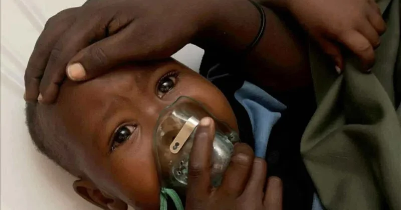 Nigeriyada Lassa qızdırması səbəbilə 151 nəfər ölüb