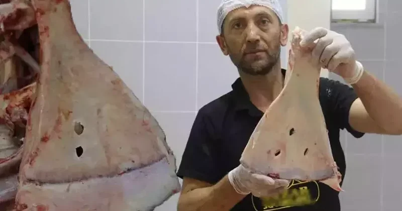 Caduyla mübarizə: 240 sümükdən ikisini qırırlar