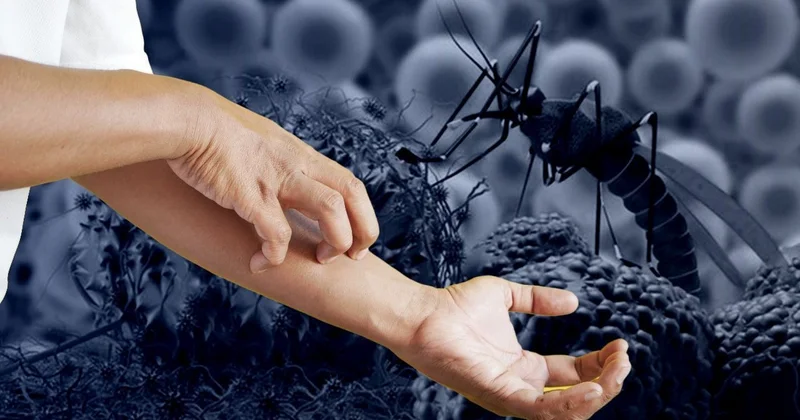 Yunanıstanda virus həyəcanı: Ölənlər var