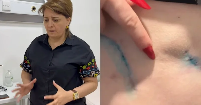 Prokurorluqda pasiyentin ölüm işində adı keçən həkim yenidən cərrahlıq edir?