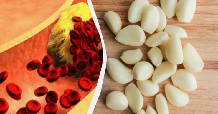 Xolesterini salmaq üçün bu qidanı çiy yeyin Alimlər 5 təsirini açıqladı