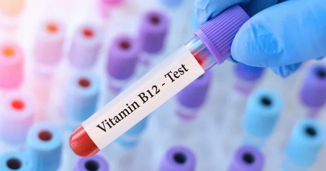 Qanında B12 vitamini yüksək olanlara XƏBƏRDARLIQ