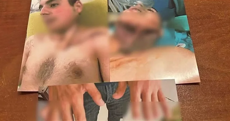 Раненому во время 44 дневной войны отказали в продлении инвалидности: ответ TƏBİB
