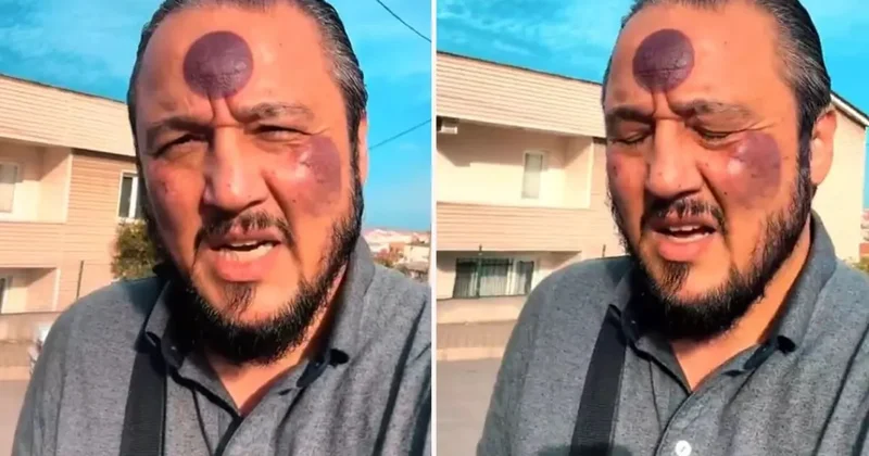 Üzünə hicama etdirən kişi görün nə HALA düşdü VİDEO