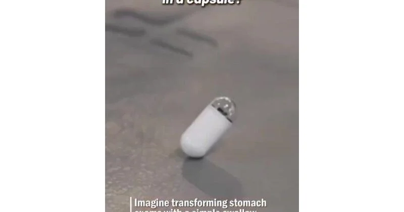 В Китае создали капсулу робота для безболезненной гастроскопии ВИДЕО