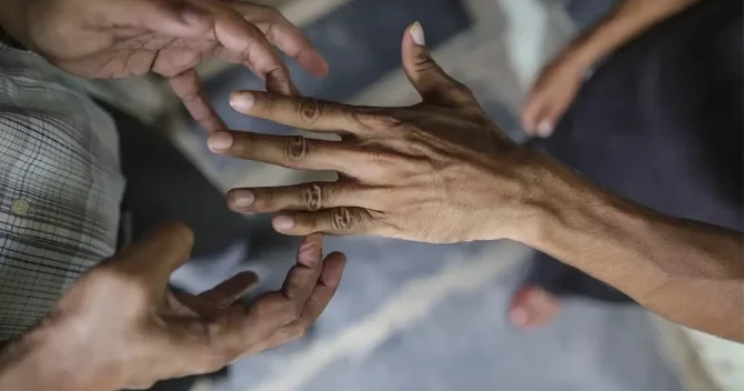 Rumıniyada 44 il sonra ilk dəfə cüzam xəstəsi aşkarlandı