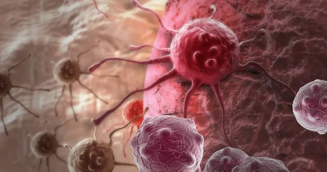 Xərçəngin “qatili” TAPILDI