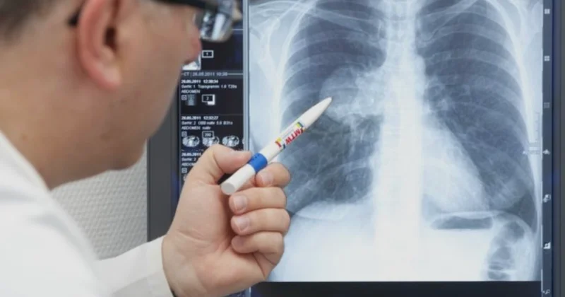 “Erkən diaqnoz infeksion xəstəliklərin müalicəsində həlledici rol oynayır” MÜNASİBƏT BİLDİRİLDİ