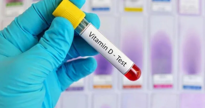 Vitamin D 100 olarsa heç bir xəstəlik tapmazsınız Kardioloq