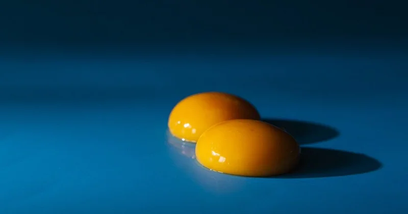 Bu problemi olanlar, yumurta sarısına “yox” desin