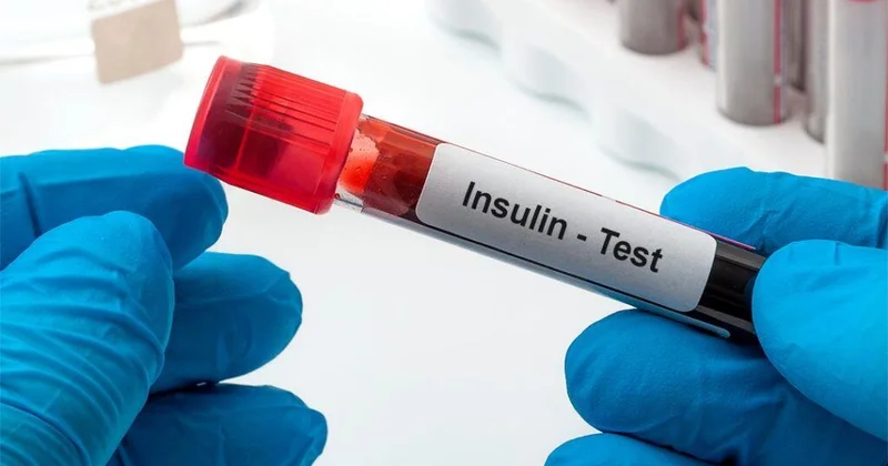 Ürək xəstəliklərinin əsas səbəbi insulin dirəncidir Kardioloqdan VİDEO