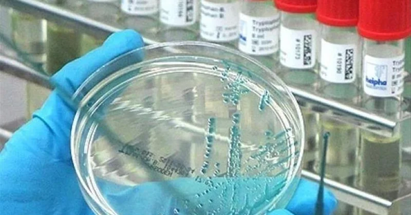 ABŞ da hantavirus təhlükəsi artır