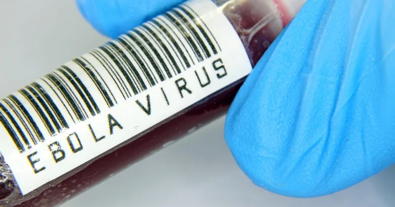 ÜST: Ebola virusu sürətlə yayılır