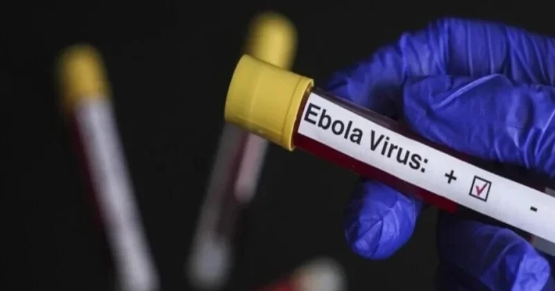 ÜST Ebola virusu riski altında olan ölkələri açıqlayıb