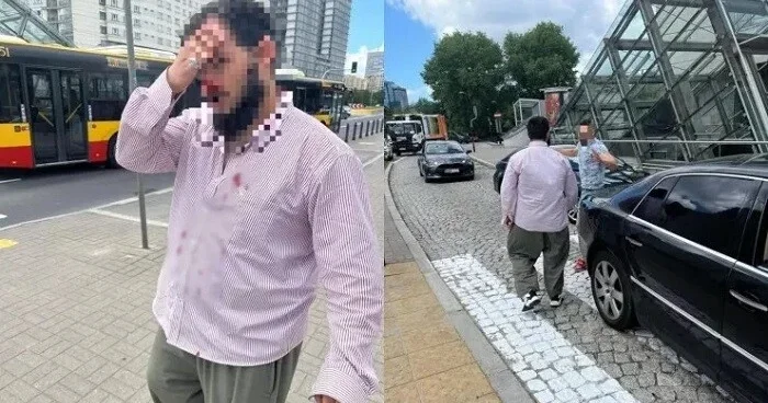 Polşada azərbaycanlı taksi sürücüsünü döyənə cinayət işi açıldı