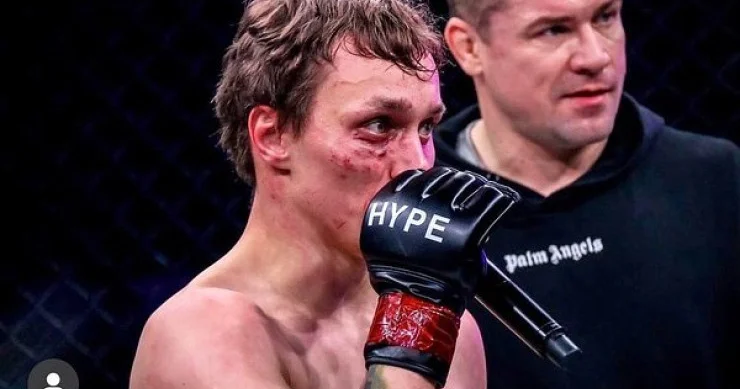 Qız MMA döyüşçüsünün gözünü çıxartdı