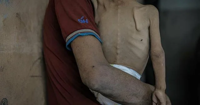 Son 24 saatda 10 fələstinli aclıqdan ölüb