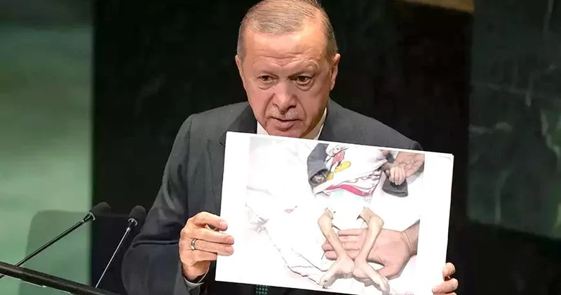 Ərdoğan BMT də dəhşətli fotolar göstərdi FOTOLAR