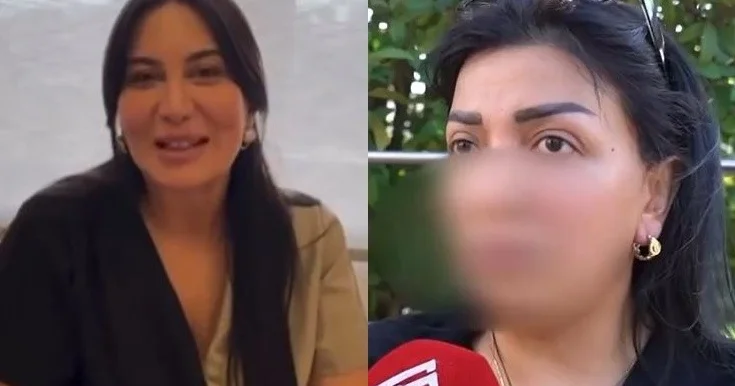 Əməliyyatdan sonra üzünün iflic olduğunu iddia edir: Gözlərim yumulmur