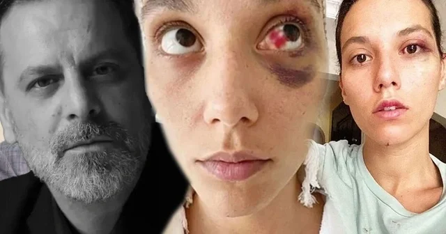 45 yaşlı aktyor sevgilisini döydüyünə görə 45 gün həbsxanada qalacaq