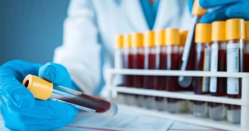 Həyat tərziniz genetikanızla uyğun gəlirmi? Bu testlər sizi gələcəyə hazırlayır