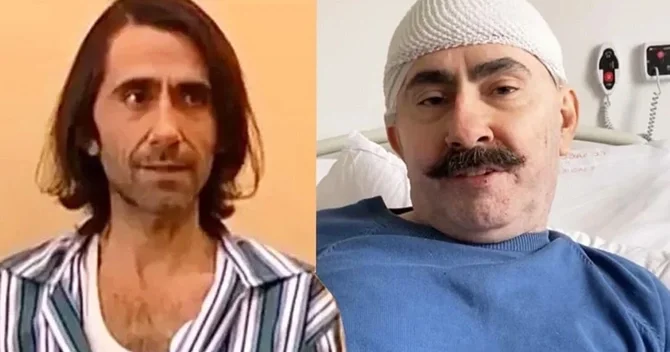 Beyninə qan sızan aktyorun SON HALI