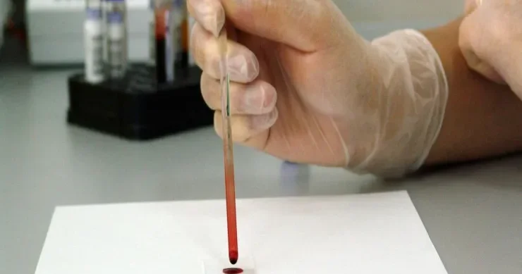 Onkoloji sıçrayış: Bir qan testi onlarla xərçəng növünü aşkar edə bilər