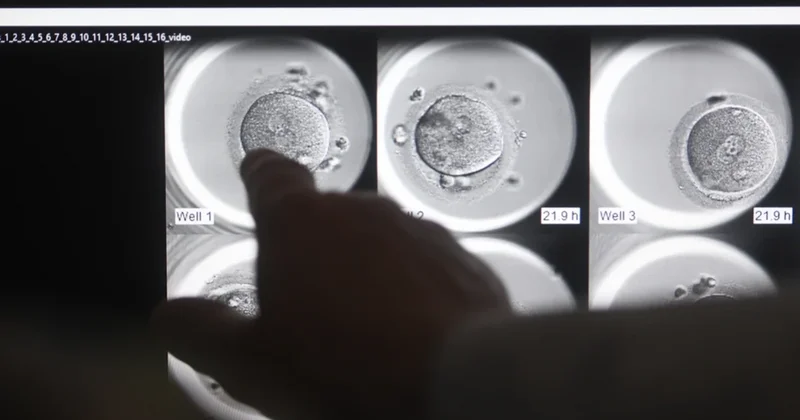 Süni mayalanma qadın sağlamlığını məhv edir? Rusiyalı həkimdən AÇIQLAMA