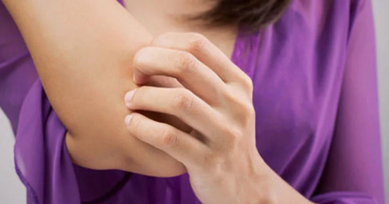 Dəri niyə qaşınır? 15 ən yayılmış səbəb