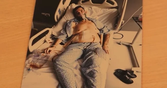 Təkrar mədəkiçiltmə əməliyyatı ciddi fəsadlar yaratdı