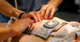 Bayramlarda ürək tutmaları niyə artır?