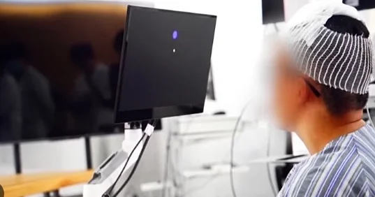 Elmi möcüzə implant əlil adama ikinci həyat verdi