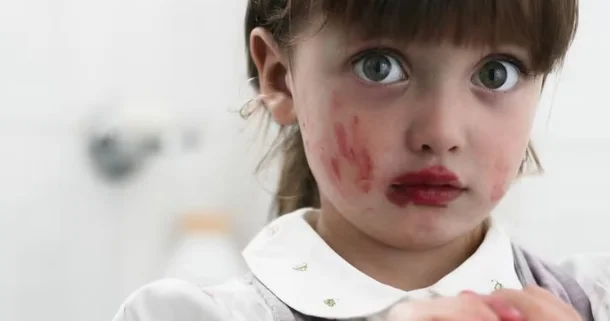 Dermatoloq xəbərdarlıq edir: Bu vasitələr uşaqlar üçün risklidir