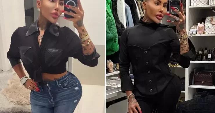 Kim Kardaşyana bənzəmək üçün əməliyyat etdirən məşhur ÖLDÜ
