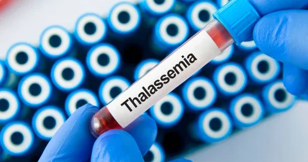 В Азербайджане официально зарегистрированы 3 190 пациентов с талассемией