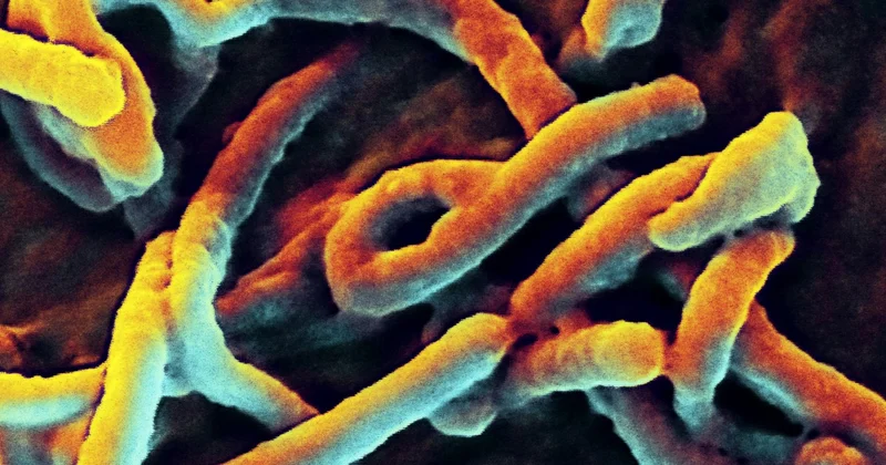 Bu xəstəliyi Ebola ilə qarışıq salırlar