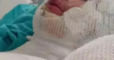 Mirasa görə 16 yaşlı qardaşı oğlunu yandırdı FOTO