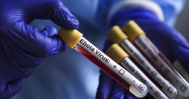 Fransada Ebola virusu aşkarlandı