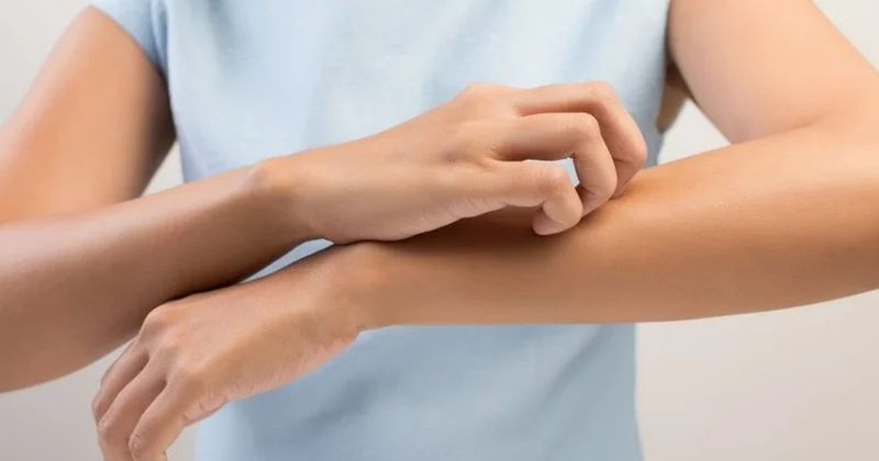 Qaşınması bu xəstəlikdən xəbər verir