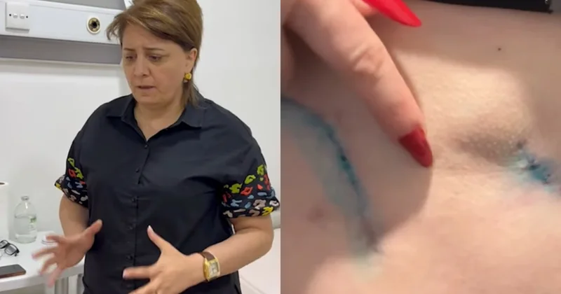 Xəstələri ölümcül hala salan saxta cərrah barədə şok faktlar: Bədənim çürüyüb