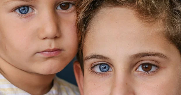 Göz rəngini dəyişmək istəyənlər, bilin: “Bu prosedur geri dönüşsüzdür”
