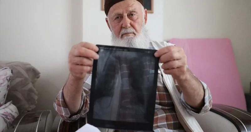 Siqaretə görə 3 barmağını itirdi FOTOLAR